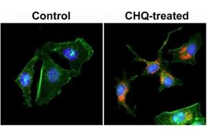 ICC staining of human HeLa cells untreated or treated with chloroquine (CHQ), with recombinant LC3B antibody (red) at 1:200 dilution. (Recombinant LC3B antibody  (N-Term))