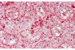 Detection of GUSb in Human Spleen Tissue using Polyclonal Antibody to Glucuronidase Beta (GUSb) (Glucuronidase beta antibody  (AA 451-649))