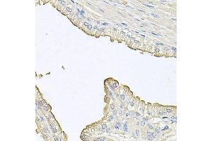 Immunohistochemistry of paraffin-embedded human prostate using FABP12 antibody at dilution of 1:100 (x40 lens).
