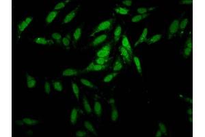 Immunofluorescence staining of Hela cells with ABIN7151937 at 1:100, counter-stained with DAPI. (ESRP2 antibody  (AA 615-720))