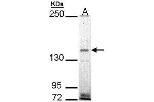 WB Image Sample (30 ug of whole cell lysate) A: H1299 5% SDS PAGE antibody diluted at 1:1000 (EHBP1 antibody)