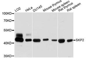 Western blot analysis of extracts of various cell lines, using SKP2 antibody.