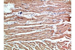 Immunohistochemical analysis of paraffin-embedded human-heart, antibody was diluted at 1:200 (NLRX1 antibody  (AA 581-630))