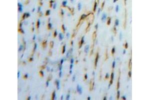 Used in DAB staining on fromalin fixed paraffin-embedded Heart tissue (PCOLCE antibody  (AA 36-468))