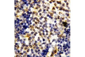 Anti-Granzyme A antibody, IHC(P) IHC(P): Human Tonsil Tissue (GZMA antibody  (Middle Region))