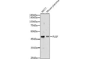 Western blot analysis of extracts of various cell lines, using PLGF antibody (ABIN7269385) at 1:500 dilution. (PLGF antibody)