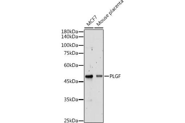 PLGF 抗体