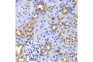 Immunohistochemistry of paraffin-embedded rat kidney using GIP antibody (ABIN5973668) at dilution of 1/100 (40x lens). (GIP antibody)