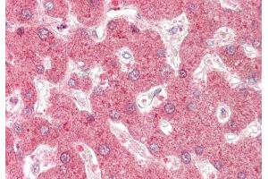 Rabbit Anti-DHODH antibody  Formalin Fixed Paraffin Embedded Tissue: Human Liver Primary antibody Concentration: 1:100 Secondary Antibody: Donkey anti-Rabbit-Cy3 Secondary Antibody Concentration: 1:200 Magnification: 20x Exposure Time: 0. (DHODH antibody  (N-Term))