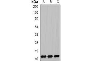 Western blot analysis of NPC2 expression in HEK293T (A), mouse lung (B), mouse liver (C) whole cell lysates. (NPC2 antibody)