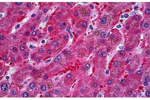 Human Liver: Formalin-Fixed, Paraffin-Embedded (FFPE) (ALDH1L1 antibody  (AA 803-903))