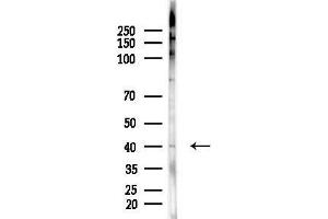 Western blot analysis of lysates from Hela cells(LPS,4h treatment), using R Antibody at 1/1000 dilution.