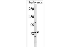 Mouse Sgk071 Antibody (N-term) (ABIN1539046 and ABIN2849427) western blot analysis in human placenta tissue lysates (35 μg/lane). (C9orf96 antibody  (N-Term))