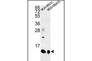 SPRR1B Antikörper  (C-Term)
