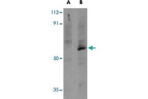 Western blot analysis of TRAF6 in PC-3 cell lysates with TRAF6 polyclonal antibody  at 1 ug/mL in the presence (A) or absence (B) of 1 ug blocking peptide.