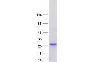 Western Blotting (WB) image for Lipocalin 2 (LCN2) protein (Myc-DYKDDDDK Tag) (ABIN2724812)