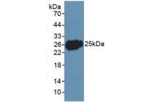 Western blot analysis of recombinant Human LIF. (LIF antibody  (AA 2-201))