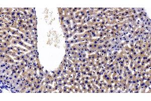 Immunohistochemistry (IHC) image for anti-C-Reactive Protein (CRP) (AA 17-224) antibody (ABIN7442345)