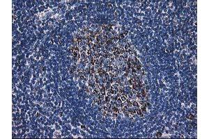 Image no. 5 for anti-Dihydrolipoamide Dehydrogenase (DLD) antibody (ABIN1497845) (DLD antibody)