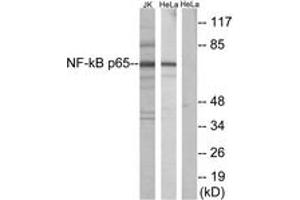 Western blot analysis of extracts from Jurkat/HeLa, using NF-kappaB p65 (Ab-529) Antibody. (NF-kB p65 antibody  (AA 496-545))