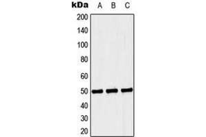 Western blot analysis of Septin 6 expression in Jurkat (A), NIH3T3 (B), PC12 (C) whole cell lysates.