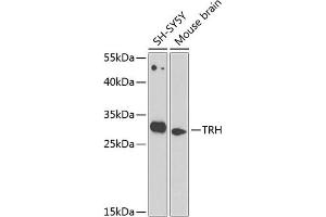 Western blot analysis of extracts of various cell lines, using TRH antibody (ABIN6130919, ABIN6149488, ABIN6149489 and ABIN6224343) at 1:1000 dilution. (TRH antibody  (AA 25-230))