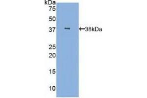 Detection of Recombinant MBL, Human using Polyclonal Antibody to Mannose Binding Lectin (MBL) (MBL2 antibody  (AA 42-96))