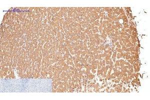 Immunohistochemistry of paraffin-embedded Human liver tissue using CD16 Monoclonal Antibody at dilution of 1:200. (CD16 antibody)