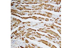 Anti-Cardiac FABP antibody, IHC(P) IHC(P): Rat Cardiac Muscle Tissue (FABP3 antibody  (C-Term))