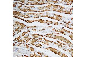 Anti-Cardiac FABP antibody, IHC(P) IHC(P): Rat Cardiac Muscle Tissue
