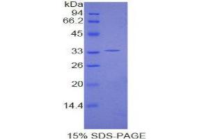 SDS-PAGE (SDS) image for Karyopherin alpha 1 (Importin alpha 5) (KPNA1) (AA 239-506) protein (His tag) (ABIN1877901) (KPNA1 Protein (AA 239-506) (His tag))