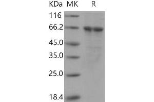 Western Blotting (WB) image for Polo-Like Kinase 1 (PLK1) (Active) protein (His tag) (ABIN7317096) (PLK1 Protein (His tag))
