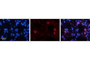NFATC4 antibody - N-terminal region          Formalin Fixed Paraffin Embedded Tissue:  Human Lung Tissue    Observed Staining:  Cytoplasm of pneumocytes   Primary Antibody Concentration:  1:600    Secondary Antibody:  Donkey anti-Rabbit-Cy3    Secondary Antibody Concentration:  1:200    Magnification:  20X    Exposure Time:  0.