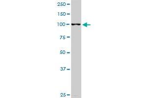 RABGAP1L monoclonal antibody (M05), clone 2D3. (RABGAP1L antibody  (AA 1-110))