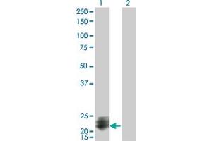 Western Blot analysis of STMN2 expression in transfected 293T cell line by STMN2 monoclonal antibody (M07), clone 2G7.