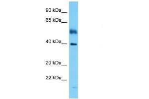 Host:  Rabbit  Target Name:  IRF1  Sample Tissue:  Human Esophagus Tumor  Antibody Dilution:  1ug/ml (IRF1 antibody  (Middle Region))