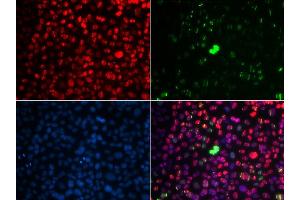 Immunofluorescence (IF) image for anti-Ataxia Telangiectasia Mutated (ATM) (pSer1981) antibody (ABIN3019429)