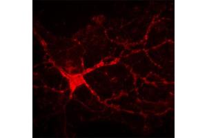 Indirect immunostaining of rat hippocampal neuron growing on astrocyte layer (dilution 1 : 200). (TNC antibody)