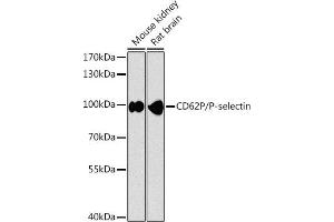 Western blot analysis of extracts of various cell lines, using CD62P/P-selectin antibody (ABIN6131513, ABIN6147502, ABIN6147505 and ABIN6216165) at 1:1000 dilution. (P-Selectin antibody  (AA 220-319))