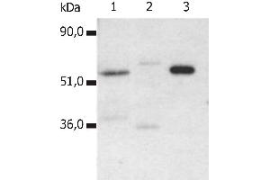 Immunoprecipitation of human CD4 from the lysate T cells isolated from fresh buffy coats. (CD4 antibody)