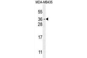 Western Blotting (WB) image for anti-Myc Target 1 (MYCT1) antibody (ABIN2995689)