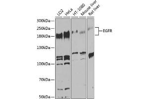 Western blot analysis of extracts of various cell lines, using EGFR antibody (ABIN6133679, ABIN6139975, ABIN6139980 and ABIN6215265) at 1:1000 dilution. (EGFR antibody  (AA 960-1060))