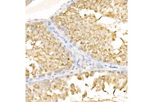 Immunohistochemistry of paraffin-embedded rat testis using KIF3A Rabbit pAb (ABIN6128170, ABIN6142871, ABIN6142872 and ABIN6222335) at dilution of 1:500 (40x lens). (KIF3A antibody  (AA 430-699))