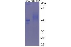 Image no. 1 for Kallikrein 1 (KLK1) peptide (Ovalbumin) (ABIN5666255) (Kallikrein 1 (KLK1) peptide (Ovalbumin))