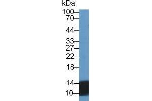 Rabbit Detection antibody from the kit in WB with Positive Control: Sample Human Urine. (Urocortin 2 ELISA Kit)
