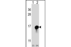 Western blot analysis of FKBP1A (arrow) using rabbit polyclonal FKBP1A Antibody (C-term) (ABIN1882082 and ABIN2841885).