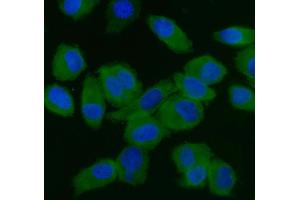 anti-Eukaryotic Translation Initiation Factor 5 (EIF5) (AA 11-423) antibody