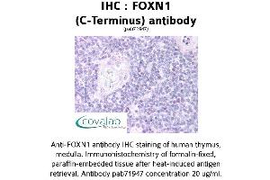 Image no. 1 for anti-Forkhead Box N1 (FOXN1) (C-Term) antibody (ABIN1734421) (FOXN1 antibody  (C-Term))