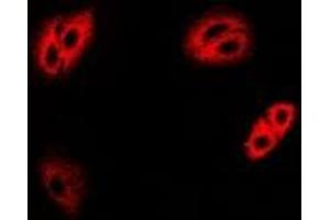 Immunofluorescent analysis of IRBP staining in MCF7 cells. (RBP3 antibody)