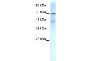 KCND3 antibody used at 1. (KCND3 antibody  (Middle Region))